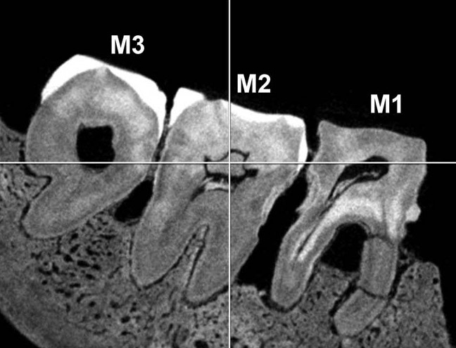 LB1 Homo floresiensis molar micro ct